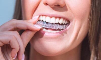 Aligners