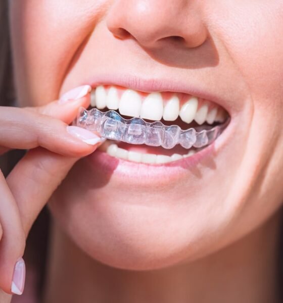Aligners